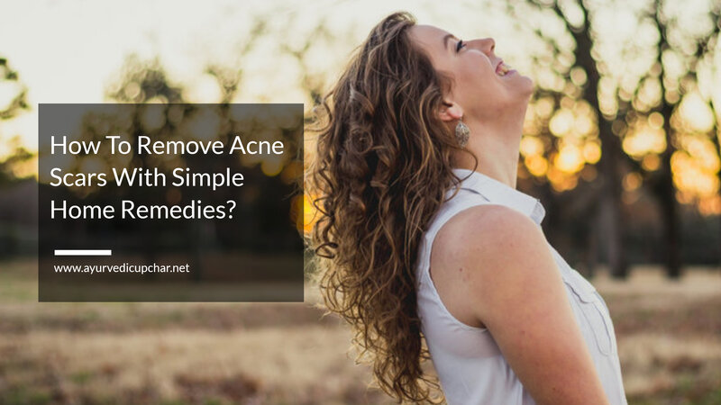 How To Remove Acne Scars With Simple Home Remedies