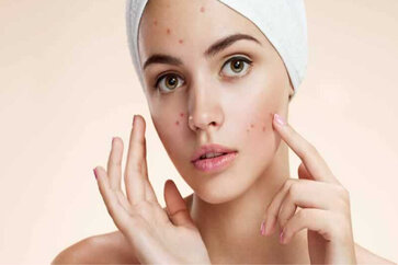 Ayurvedic Medicine For Acne Scars