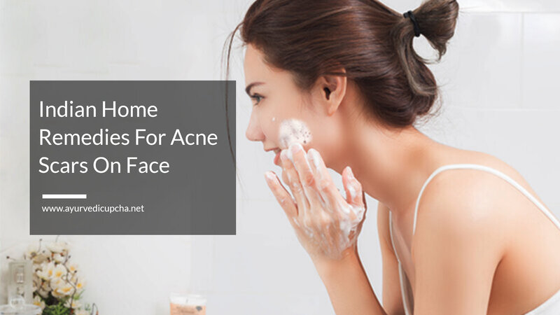 Indian Home Remedies For Acne Scars On Face